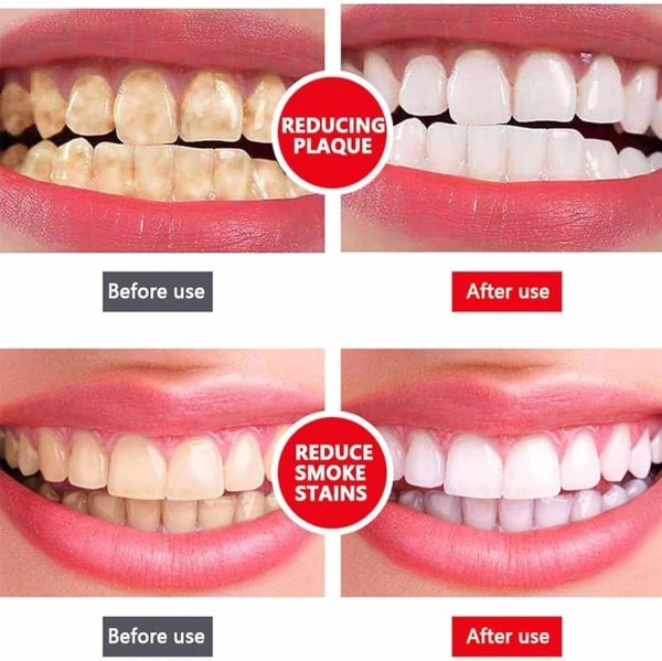 Yayashi Sp-4 Ultra Whitening Toothpaste Probiotic Stain Remover 100ml / Stain Removing Toothpaste, Protects Gums Freshens Breath, For Everyone
