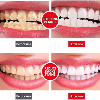Yayashi Sp-4 Ultra Whitening Toothpaste Probiotic Stain Remover 100ml / Stain Removing Toothpaste, Protects Gums Freshens Breath, For Everyone